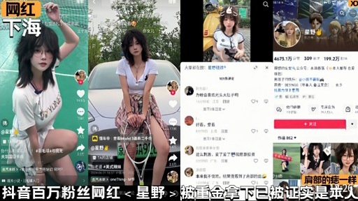 肩部的痣一样抖音百万粉丝网红星野被重金拿下已被证实是本人